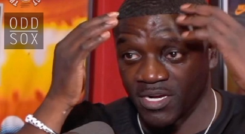 Akon admits to having hair transplant and says it only cost $7500