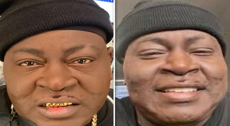 Trick Daddy replaced his famous gold teeth with veneers